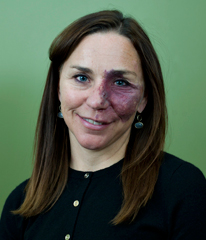 Dr. Linda Buckley Board Certified Endocrinologist